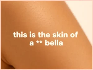 this is the skin of a killer bella